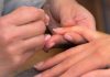 英國女子指甲上多一條線 醫生檢查驚呆
