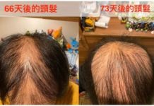 陷阱好深?日本男接種疫苗2個月後慘況曝光