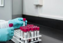 最新研究:血液測試可以預測COVID-19感染程度